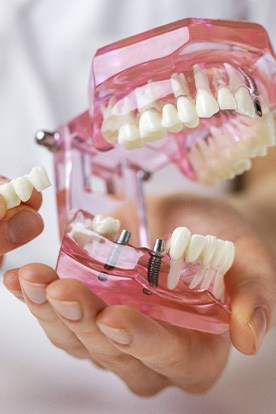 a dentist holding a dental implant model